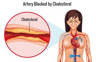 En glasskål med linfrö