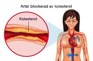Hur du kan kontrollera ditt kolesterol