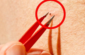 Fästingar är en fara för människor och djur