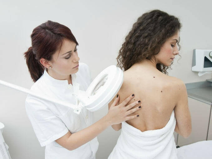 Röda födelsemärken - rygg