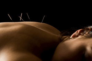 Akupunktur för tyreoidit