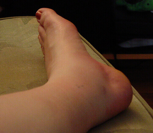 Lägg fötterna i högläge