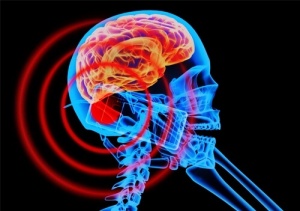 Vad är elektromagnetiska fält och hur påverkar de dig?