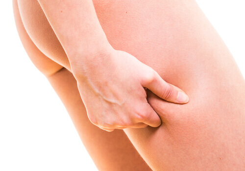 Användningar av aloe vera - mot celluliter