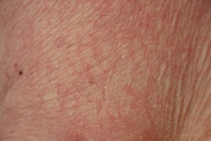 Information om din hud och din hälsa