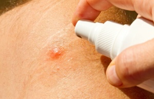 Naturliga och effektiva hemgjorda myggmedel