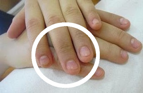 Sluta bita på naglarna - 10 effektiva tips