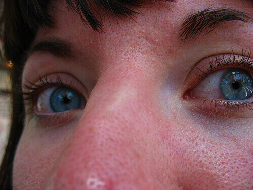 Att bli av med pormaskar tar tid och engagemang