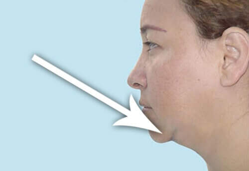 Fyra tips för att få en smalare hals