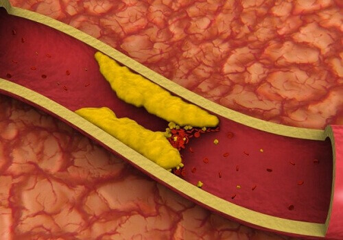 8 infusioner som hjälper dig att minska kolesterolet