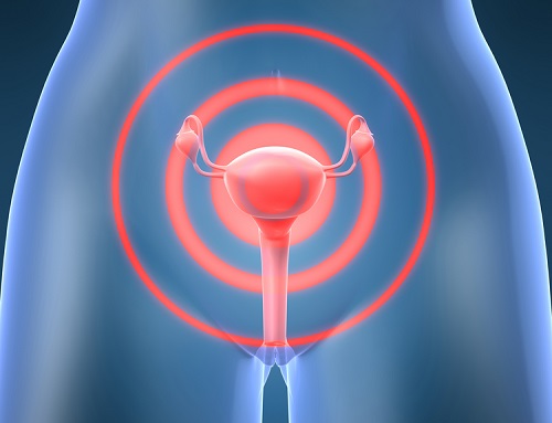 livmoderhalscancer och dess symptom