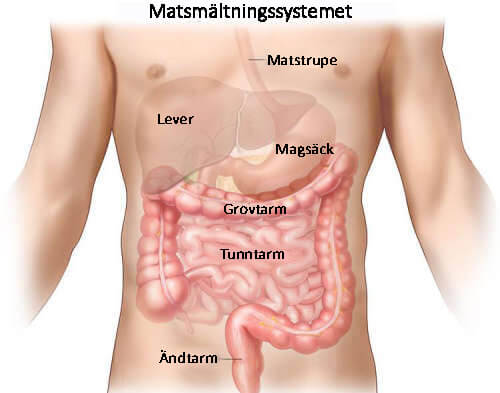 Crohns sjukdom är en irritation i en del av mag-tarmkanalen