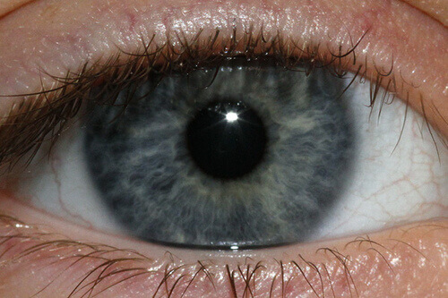 Din ögonfärg kan ge dig ledtrådar om din hälsa