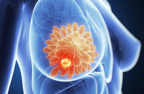 Bröstsmärtor – de 7 vanligaste orsakerna