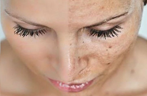 Gifter i kroppen kan leda till förtidsåldrande