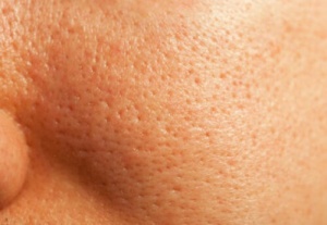 Hur man kan stänga porer i huden naturligt