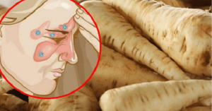 Bekämpa bihåleinflammation på 5 dagar med denna kur