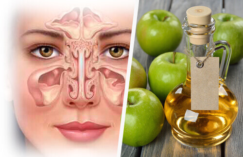 Bihålor och äppelcidervinäger