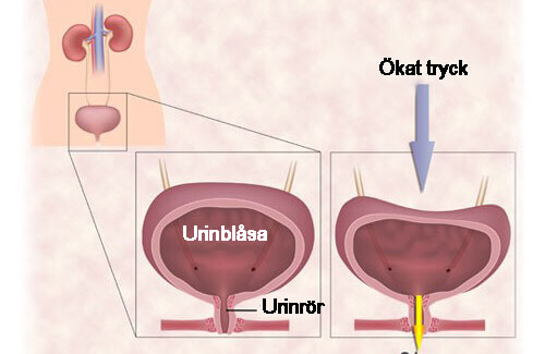 8 naturliga behandlingar för överaktiv blåsa