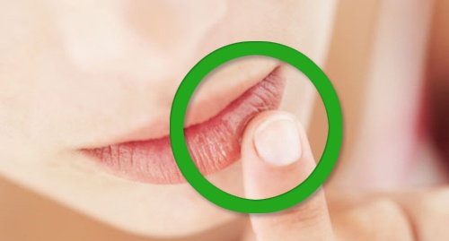 läppar Symptom på vitaminbrist
