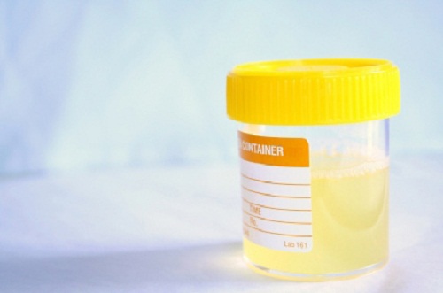 Hemgjorda kurer mot urinvägsinfektioner