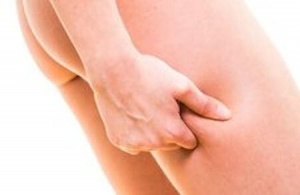 Olika tips på hur du bekämpar celluliter