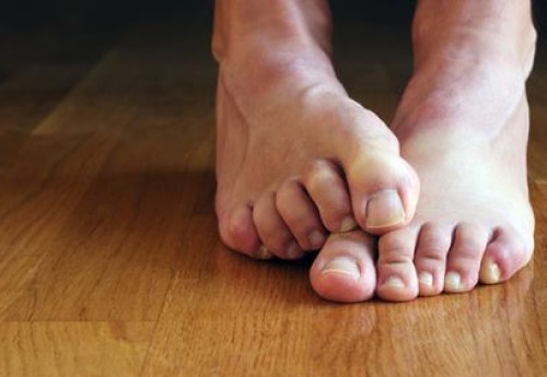 Undvik att sprida nagelsvampen