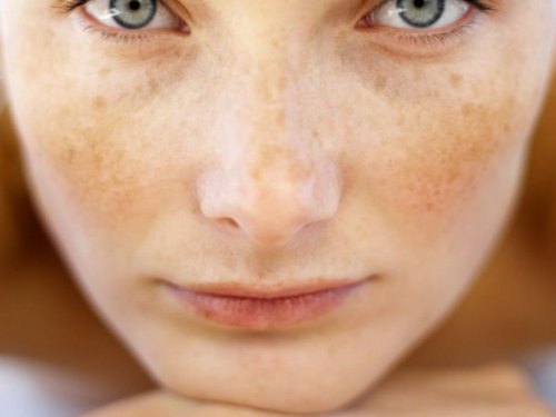 persilja mot fläckar på huden