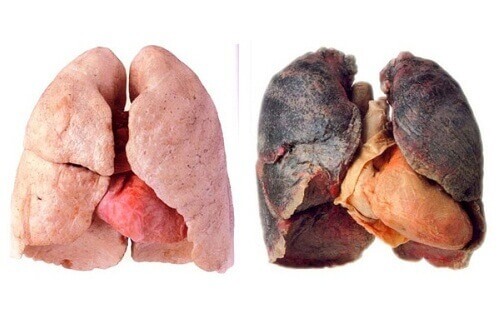 Hälsosamma tips för att få renare lungor