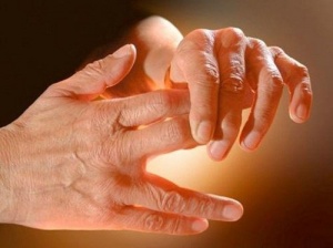 Orsaker till stickningar i händer och ben