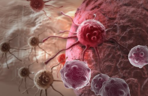 Raffinerat socker är en orsak till att cancer uppstår