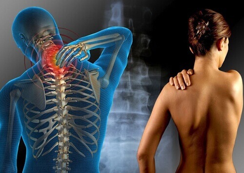 Fibromyalgi