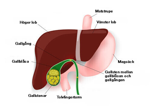Gallblåsan