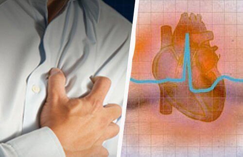 Hjärtarytmi: symtom och konsekvenser