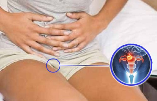 7 varningstecken för livmoderhalscancer