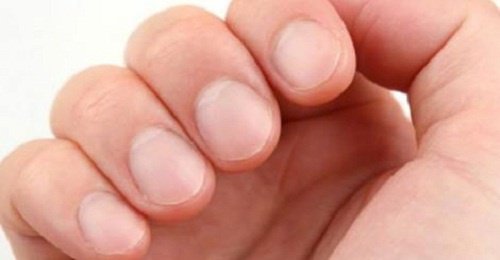 8 varningssignaler dina naglar kan ge dig om din hälsa