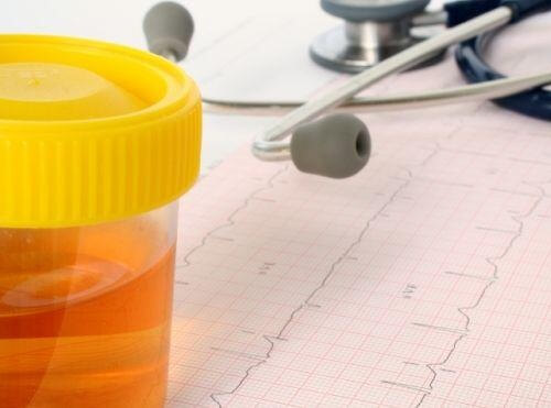 Urinen kan visa på olika signaler från kroppen