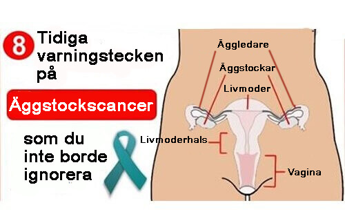 8 tidiga tecken på äggstockscancer