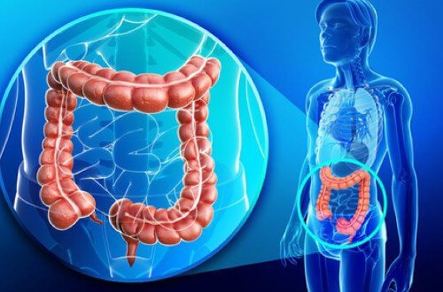 Övervikt och förgiftad grovtarm: Råd för din behandling