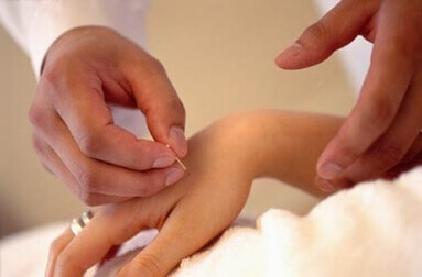 akupunkturnål appliceras