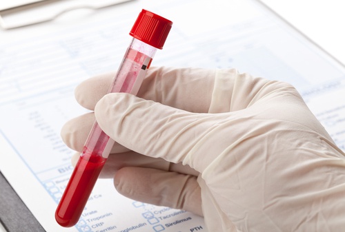 leukemiceller