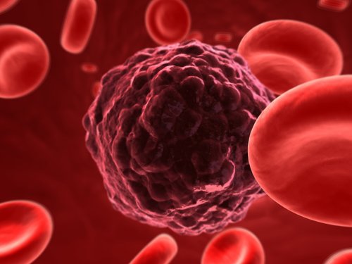 leukemiceller