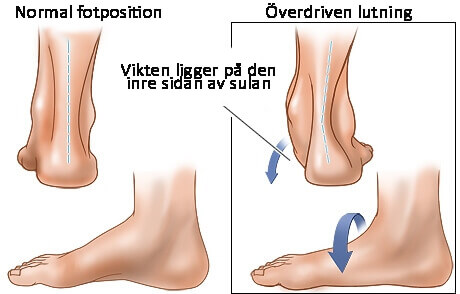 Vanor som skadar dina hälar: känner du igen dig?
