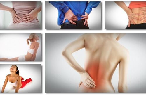 8 naturliga sätt att lindra smärta vid ischias