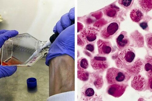 Forskare har hittat ett sätt att förstöra leukemiceller