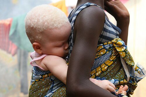 Albinobebis