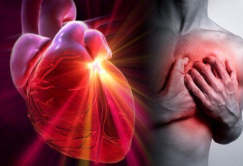 Hur du kan minska risken för hjärtinfarkt och stroke