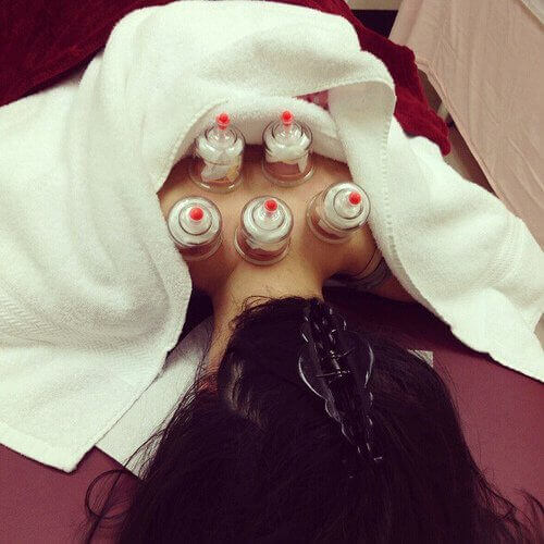 Sugkoppsmassage kan ge lindring