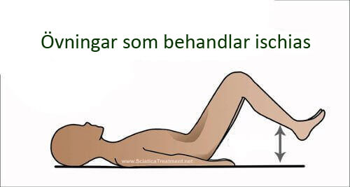 De bästa övningarna för lindring av ischias