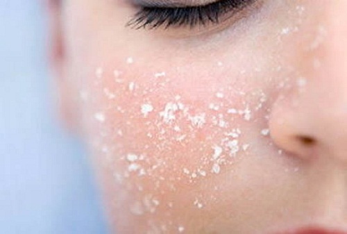 Exfolierar med salt